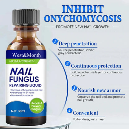 Fungal Nail Treatment Removal Oil Foot fungus Repair Essence Toe Fungus Removal Gel Anti Infection best essenice