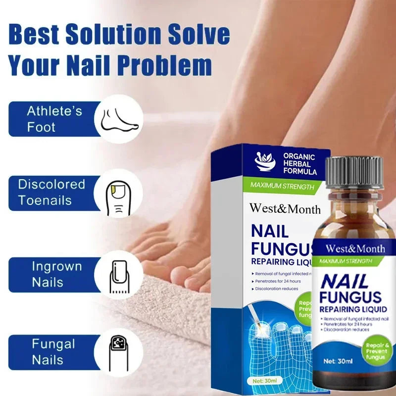 Fungal Nail Treatment Removal Oil Foot fungus Repair Essence Toe Fungus Removal Gel Anti Infection best essenice