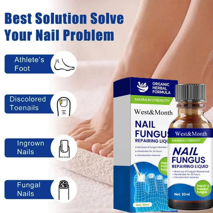 Fungal Nail Treatment Removal Oil Foot fungus Repair Essence Toe Fungus Removal Gel Anti Infection best essenice