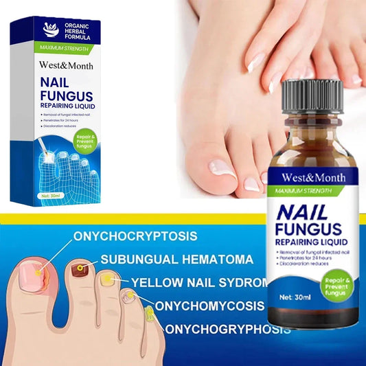 Fungal Nail Treatment Removal Oil Foot fungus Repair Essence Toe Fungus Removal Gel Anti Infection best essenice